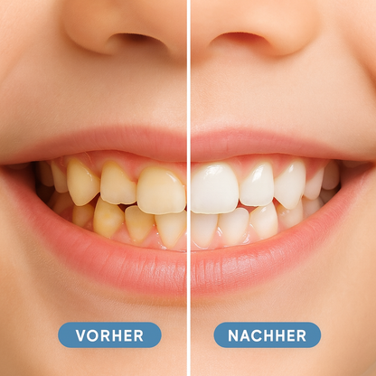 Dentisaur™ | Schluss mit dem Zahnputz-Drama